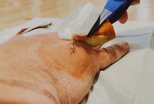 Transformer ses blessures en cicatrices