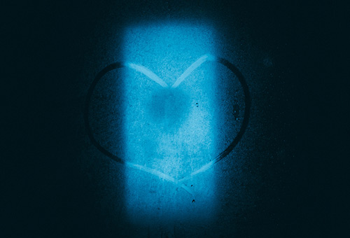 Radiographie du coeur
